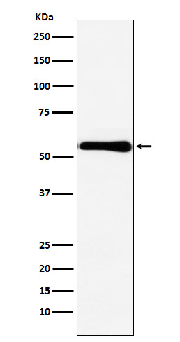 Western blot analysis of CBS expression in MCF7 cell lysate
