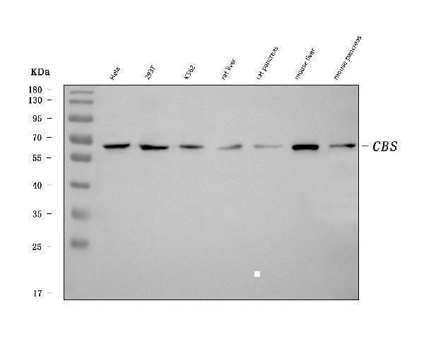  Western blot analysis of CBS using anti-CBS antibody (M00130-3)