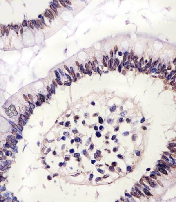 m00132 1 anti ctcf antibody center ihc p testing 3