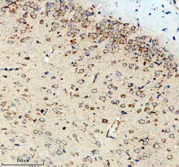 m00133 2 abl1 primary antibodies ihc testing 1
