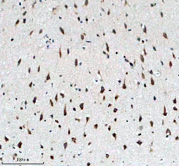 m00133 2 abl1 primary antibodies ihc testing 2