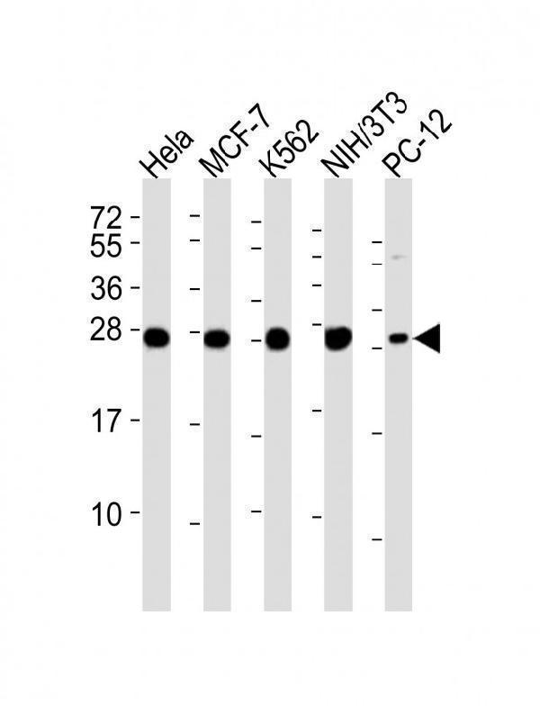 All lanes : Anti-IF4E Antibody at 1:4000 dilutionLane 1: Hela whole cell lysatesLane 2: MCF-7 whole cell lysatesLane 3: K562 whole cell lysatesLane 4: NIH/3T3 whole cell lysatesLane 5: PC-12 whole cell lysatesLysates/proteins at 20 μg per lane