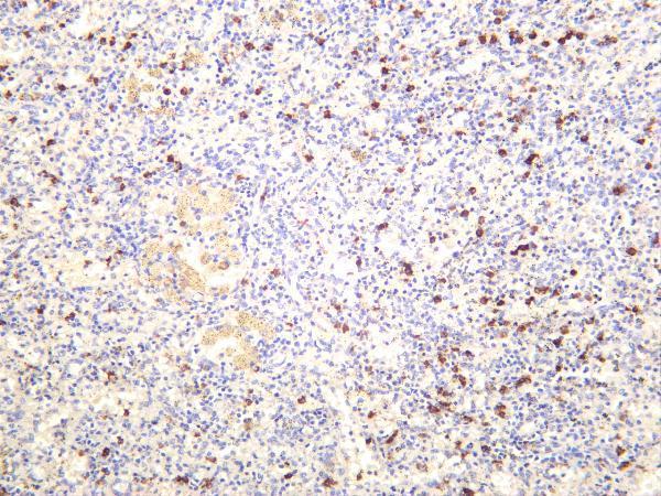 Human spleen was stained with anti-CD14 rabbit antibody