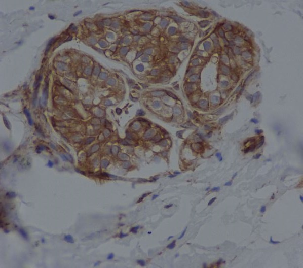 Immunohistochemical analysis of paraffin-embedded human breast, using CD14 Antibody