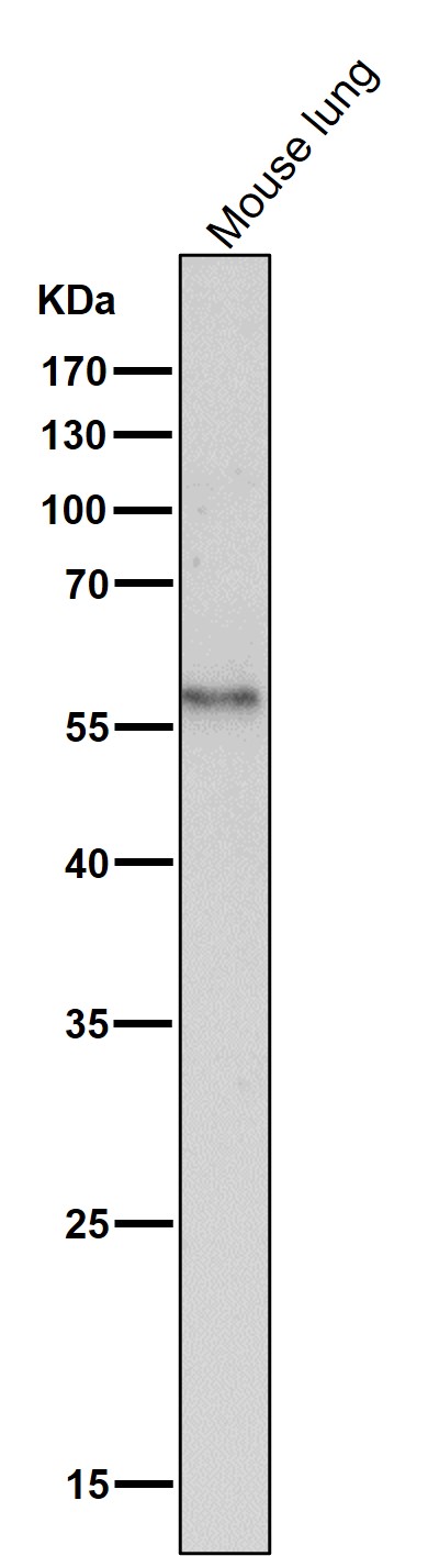 All lanes use the Antibody at 1:2K dilution for 1 hour at room temperature