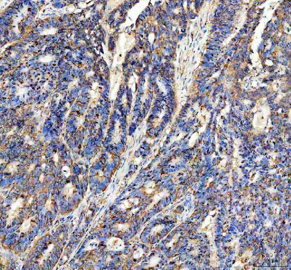 IHC analysis of Presenilin 1 using anti-Presenilin 1 antibody (M00138-1)