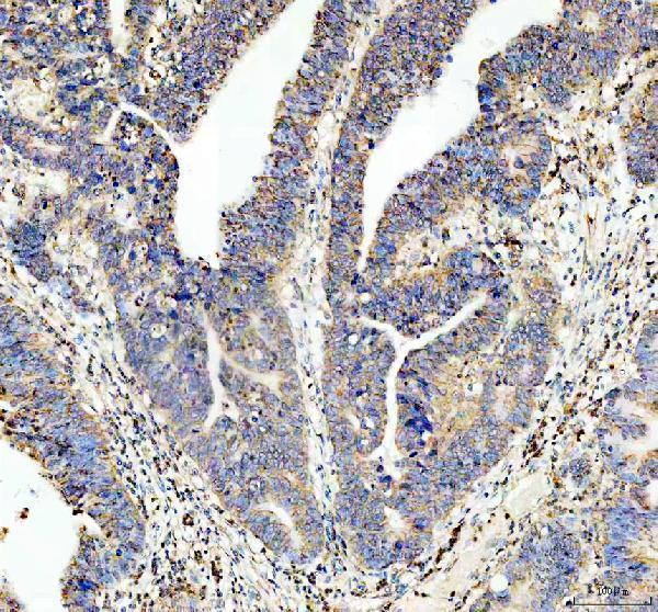 IHC analysis of Presenilin 1 using anti-Presenilin 1 antibody (M00138-1)