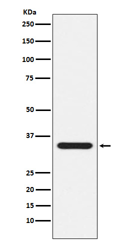 Western blot analysis of Presenilin 1 expression in Jurkat cell lysate