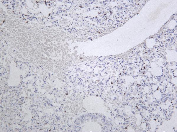 Mouse lung tissue was stained with anti-MMP9 rabbit Antibody