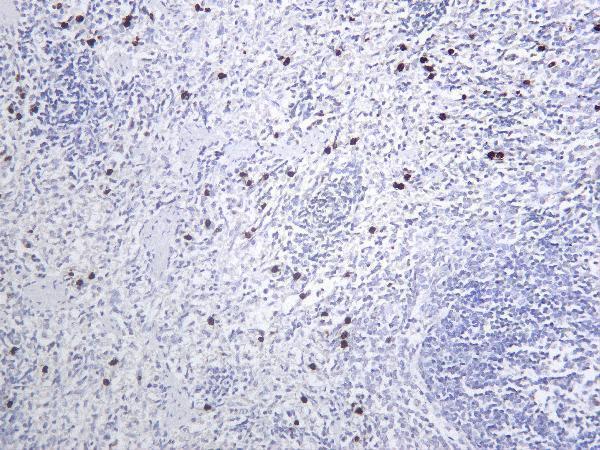 Rat spleen tissue was stained with anti-MMP9 rabbit Antibody
