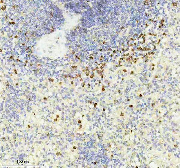 IHC analysis of MMP9 using anti-MMP9 antibody (M00139)