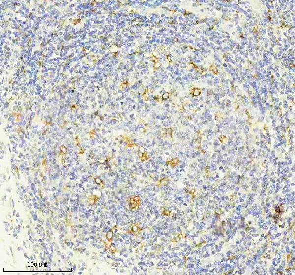 m00139 mmp9 primary antibodies ihc testing 2