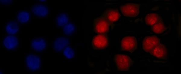 m00140 5 msh2 primary antibodies if testing 8