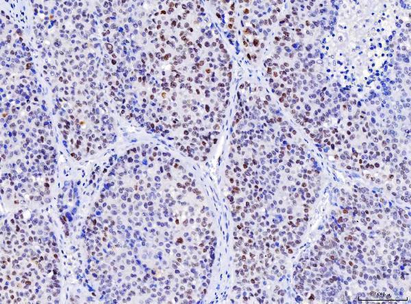 m00140 5 msh2 primary antibodies ihc testing 3