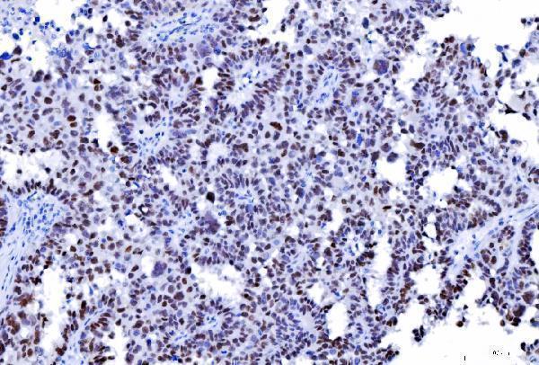 m00140 5 msh2 primary antibodies ihc testing 4