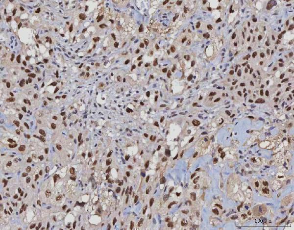 m00140 5 msh2 primary antibodies ihc testing 5