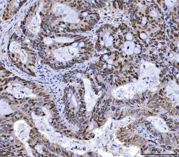 m00140 5 msh2 primary antibodies ihc testing 6