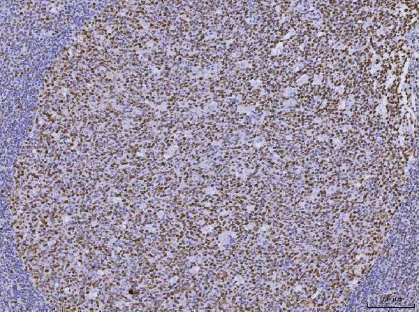 m00140 5 msh2 primary antibodies ihc testing 7