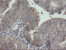 m00141 1 anti rip ripk1 mouse monoclonal antibody clone id oti2d6 ihc testing 4