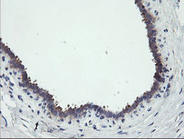 m00141 1 anti rip ripk1 mouse monoclonal antibody clone id oti2d6 ihc testing 5