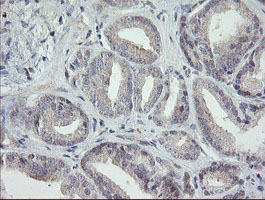 m00141 1 anti rip ripk1 mouse monoclonal antibody clone id oti2d6 ihc testing 6