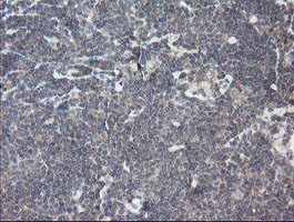 m00141 1 anti rip ripk1 mouse monoclonal antibody clone id oti2d6 ihc testing 7