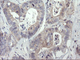 m00141 1 anti rip ripk1 mouse monoclonal antibody clone id oti2d6 ihc testing 8