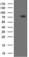 HEK293T cells were transfected with the pCMV6-ENTRY control (Left lane) or pCMV6-ENTRY RIPK1 (Right lane) cDNA for 48 hrs and lysed