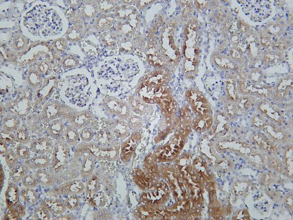 Rat kidney was stained with Anti-RIP rabbit antibody