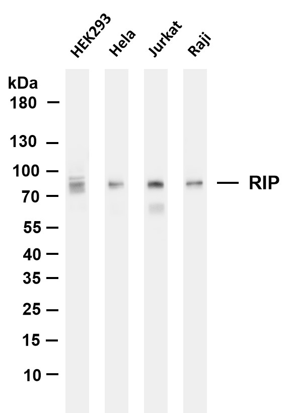 Various whole cell lysates were separated by 4-20% SDS-PAGE, and the membrane was blotted with anti-RIP antibody