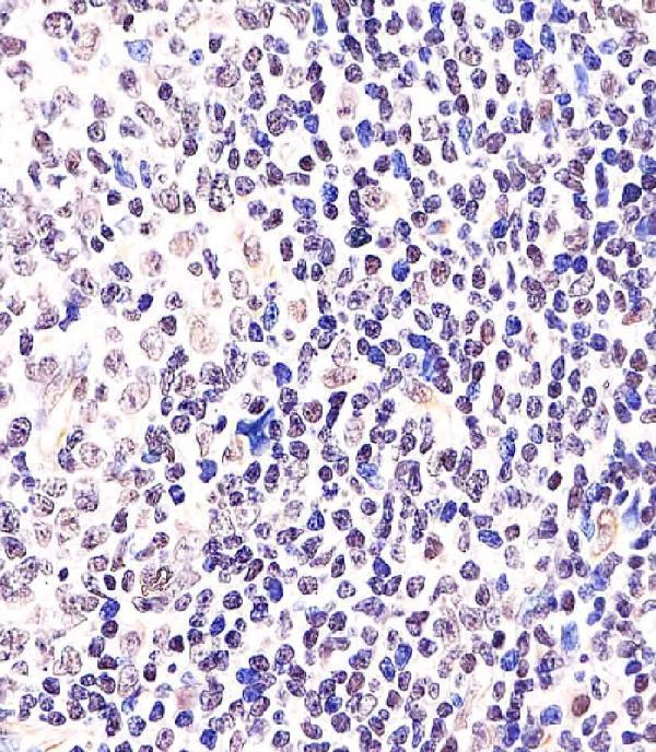 m00142 anti bcl6 antibody center ihc p testing 2