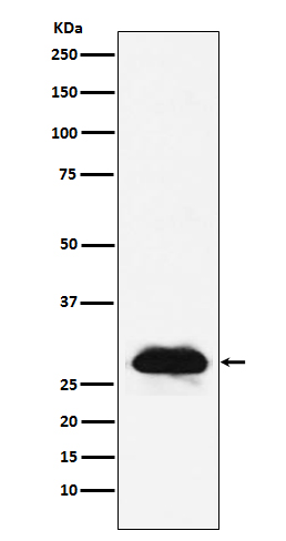 Western blot analysis of Carbonic anhydrase 2 expression in A431 cell lysate