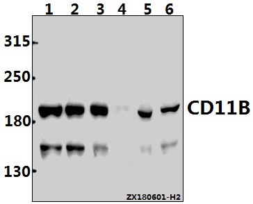 Western blot (WB) analysis of CD11B (L1) mAb at 1:500 dilution
Lane1:Myla2059 whole cell lysate(30ug)
Lane2:HuT78 whole cell lysate(30ug)
Lane3:K562 whole cell lysate(30ug)
Lane4:The Spleen tissue lysate of Rat(40ug)
Lane5:RAW264