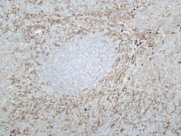 Human tonsil was stained with anti-CD11b rabbit antibody