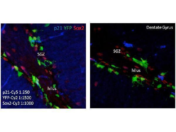 m00145 cdkn1a primary antibodies if testing 3