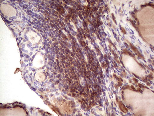 Immunohistochemical staining of paraffin-embedded Human thyroid tissue within the normal limits using anti-IGF1 mouse monoclonal antibody