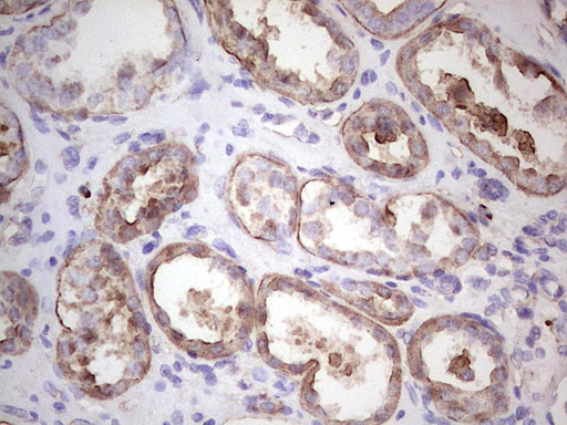 m00148 1 anti igf1 mouse monoclonal antibody clone id oti4b12 ihc testing 4