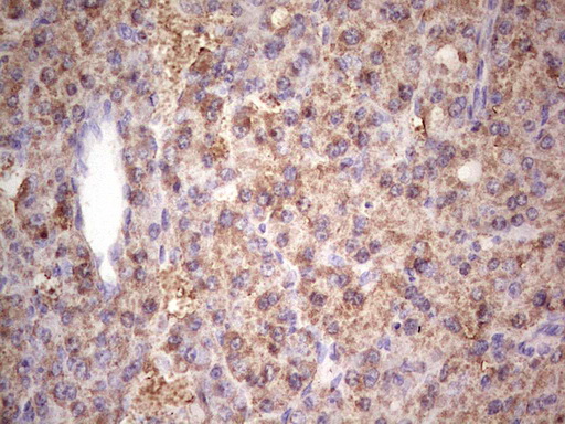 m00148 1 anti igf1 mouse monoclonal antibody clone id oti4b12 ihc testing 5