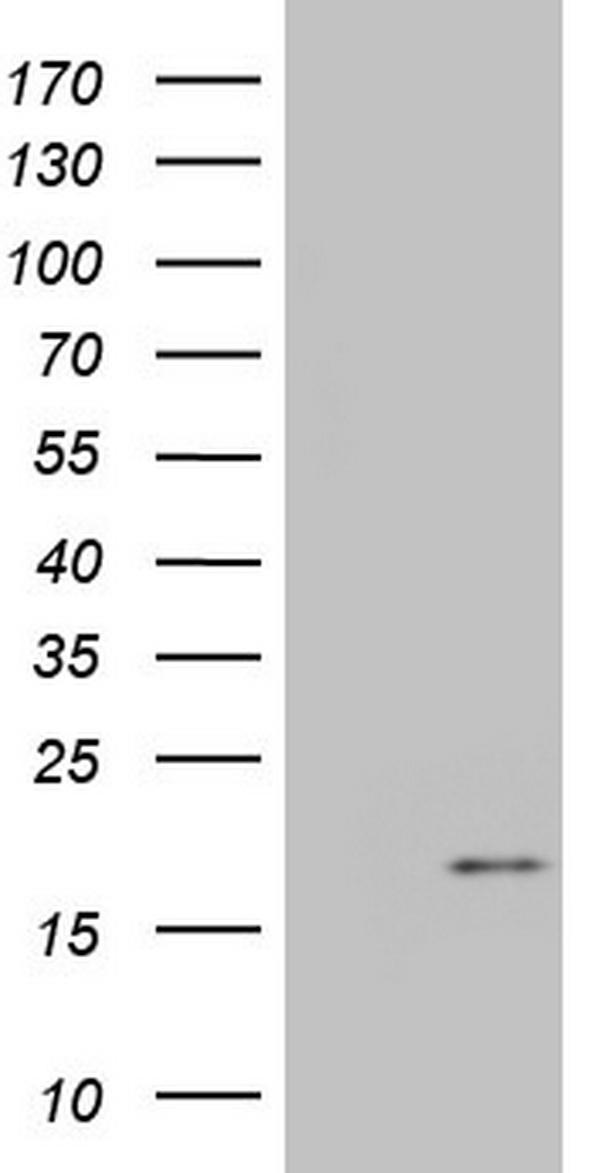 HEK293T cells were transfected with the pCMV6-ENTRY control (Left lane) or pCMV6-ENTRY IGF1 (Right lane) cDNA for 48 hrs and lysed