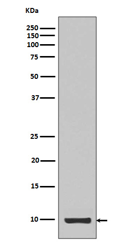 Western blot analysis of Calreticulin expression in IGF1 recombinant protein