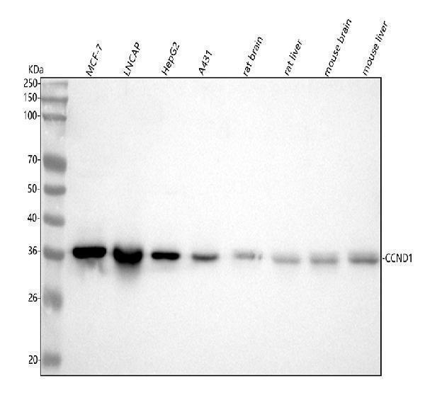  Western blot analysis of Cyclin D1 using anti-Cyclin D1 antibody (M00149-1)