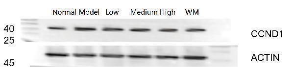 Western blot analysis of Cyclin D1 using anti-Cyclin D1 antibody (M00149-1)
