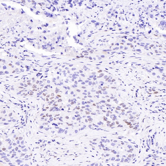 m00149 1 ihc8