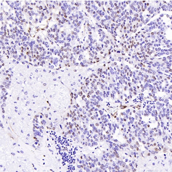 m00149 1 ihc9