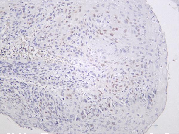 Human esophagus was stained with anti-Cyclin D1 rabbit antibody