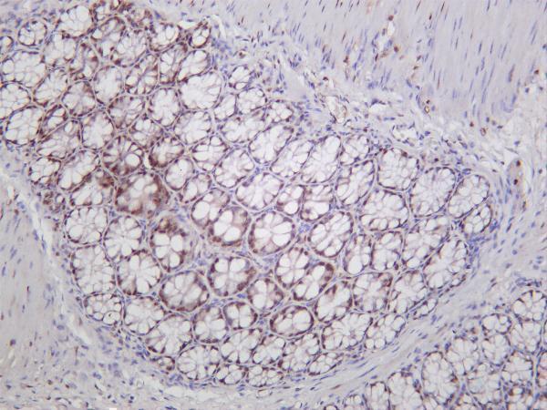 m00149 5 ccnd1 primary antibodies ihc testing 4