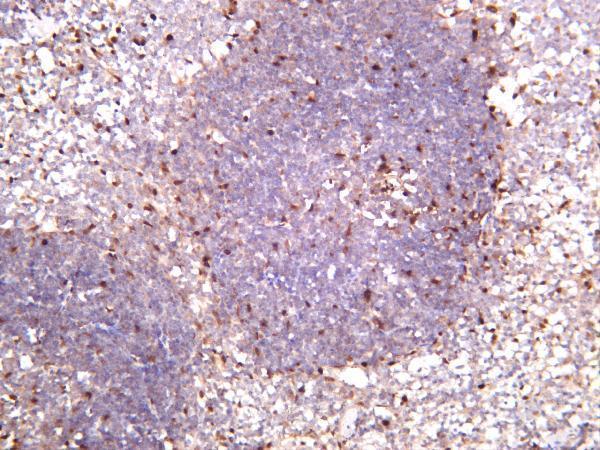 m00149 5 ccnd1 primary antibodies ihc testing 5