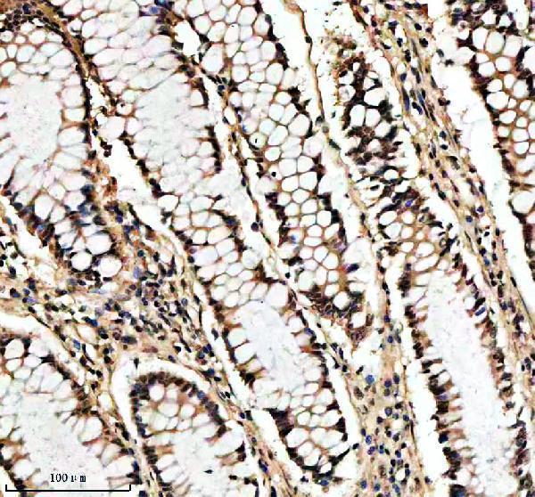 IHC analysis of SHP2/PTPN11 using anti-SHP2/PTPN11 antibody (M00150-1)