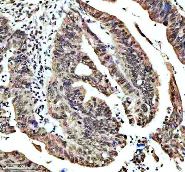  IHC analysis of SHP2/PTPN11 using anti-SHP2/PTPN11 antibody (M00150-1)