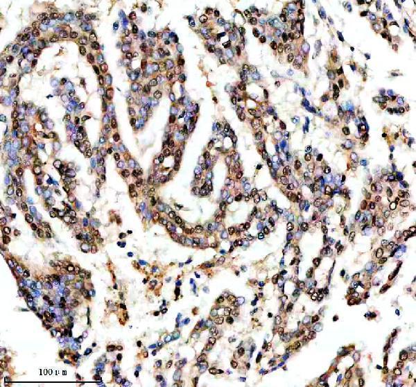 m00150 1 ptpn11 primary antibodies ihc testing 4